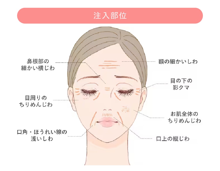 目まわりなどの細かい部分も得意