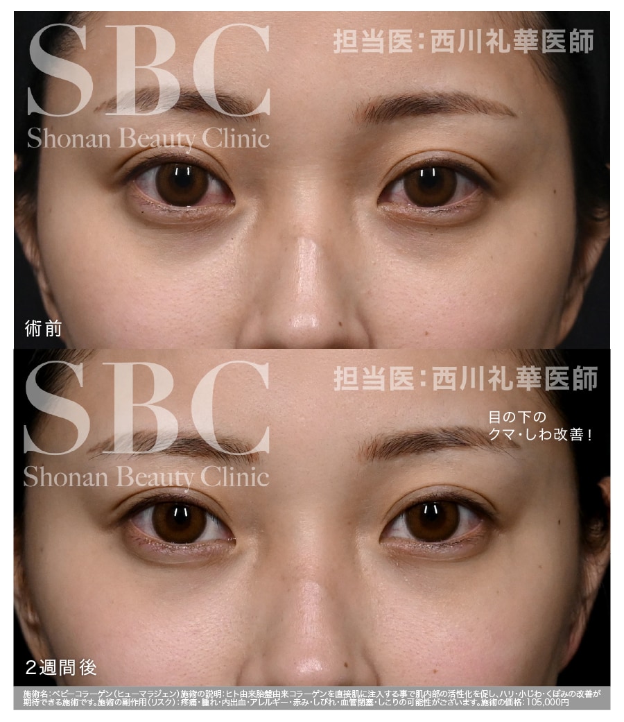 目周りや肌の若返りをしたい方に