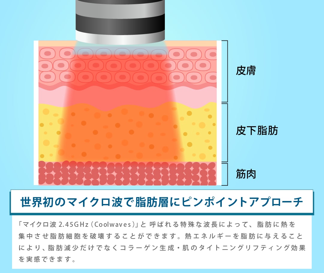 オンダリフトの仕組みと期待できる効果