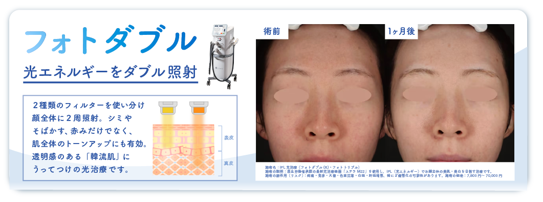 フォトダブル：広範囲のシミとくすみを同時にケア