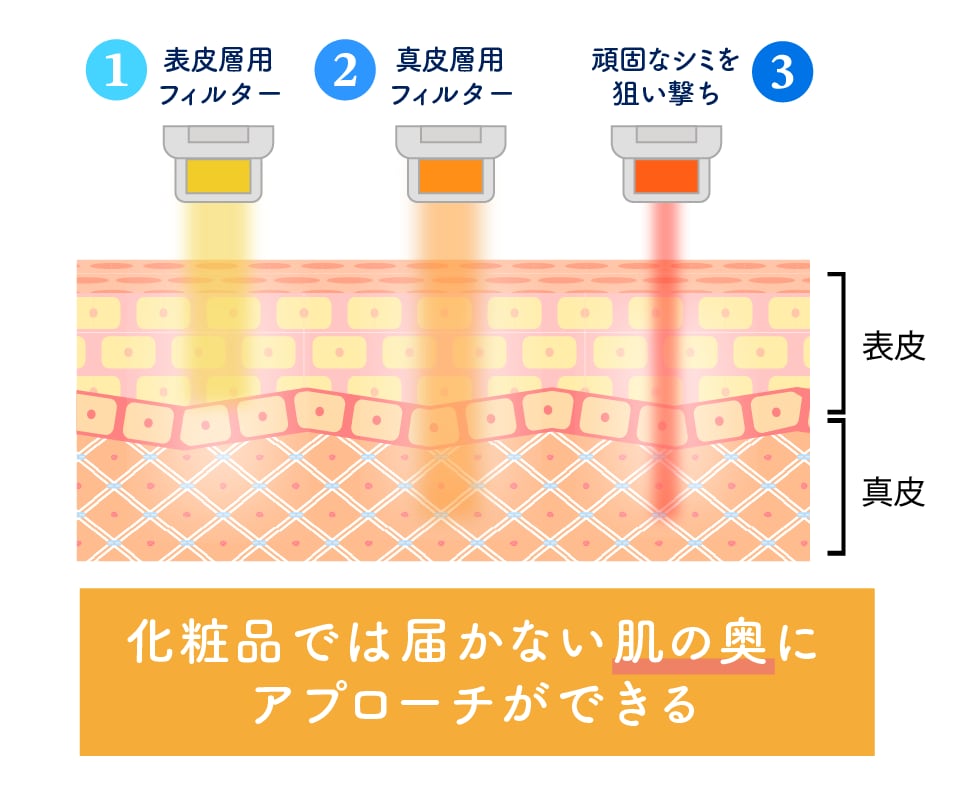医療機器だからこそ叶う、桁違いの透明感。