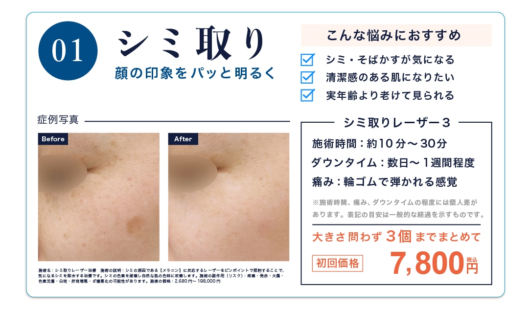 シミ取り