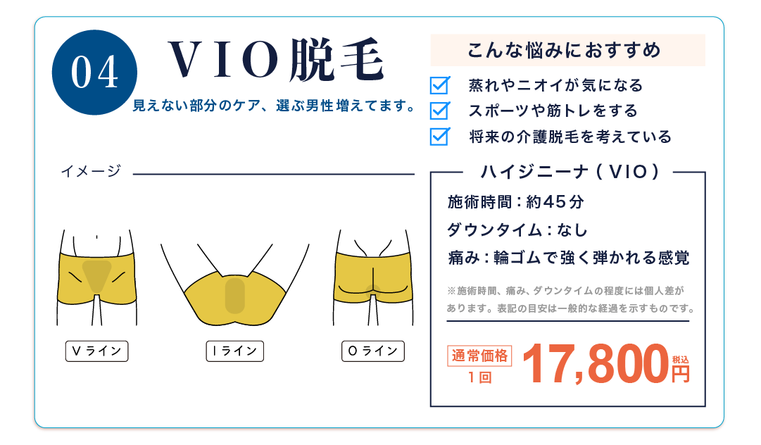 VIO脱毛