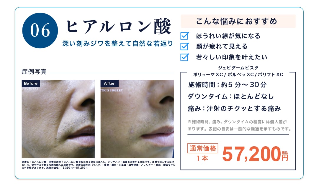 ヒアルロン酸