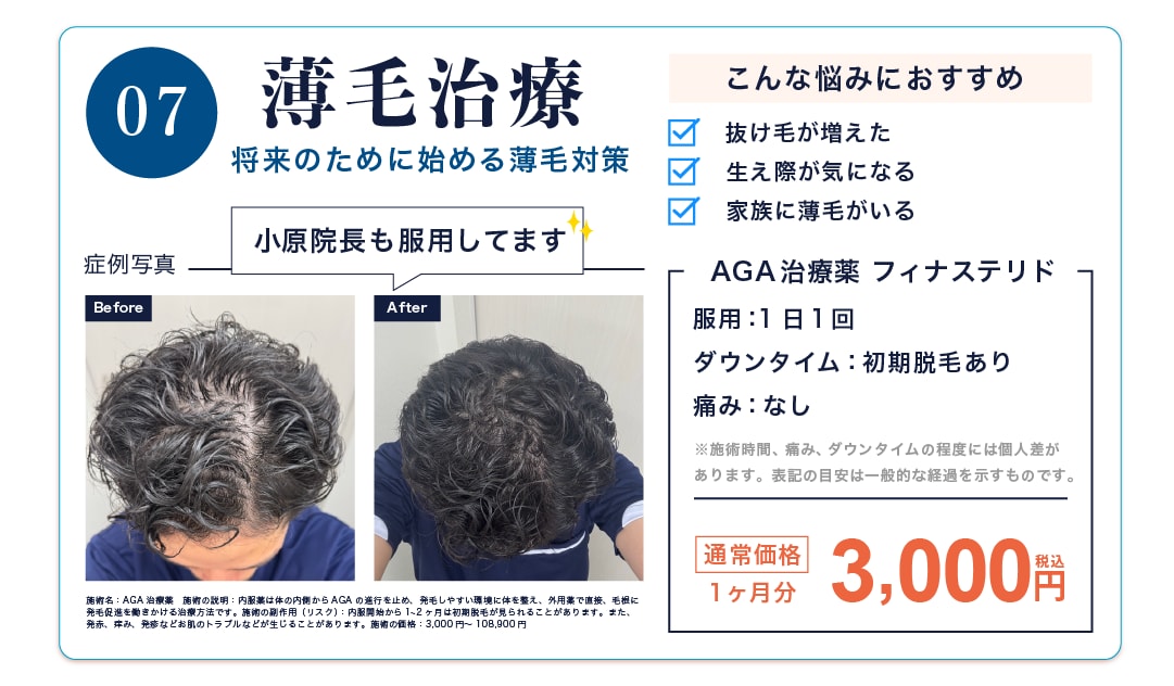 薄毛治療