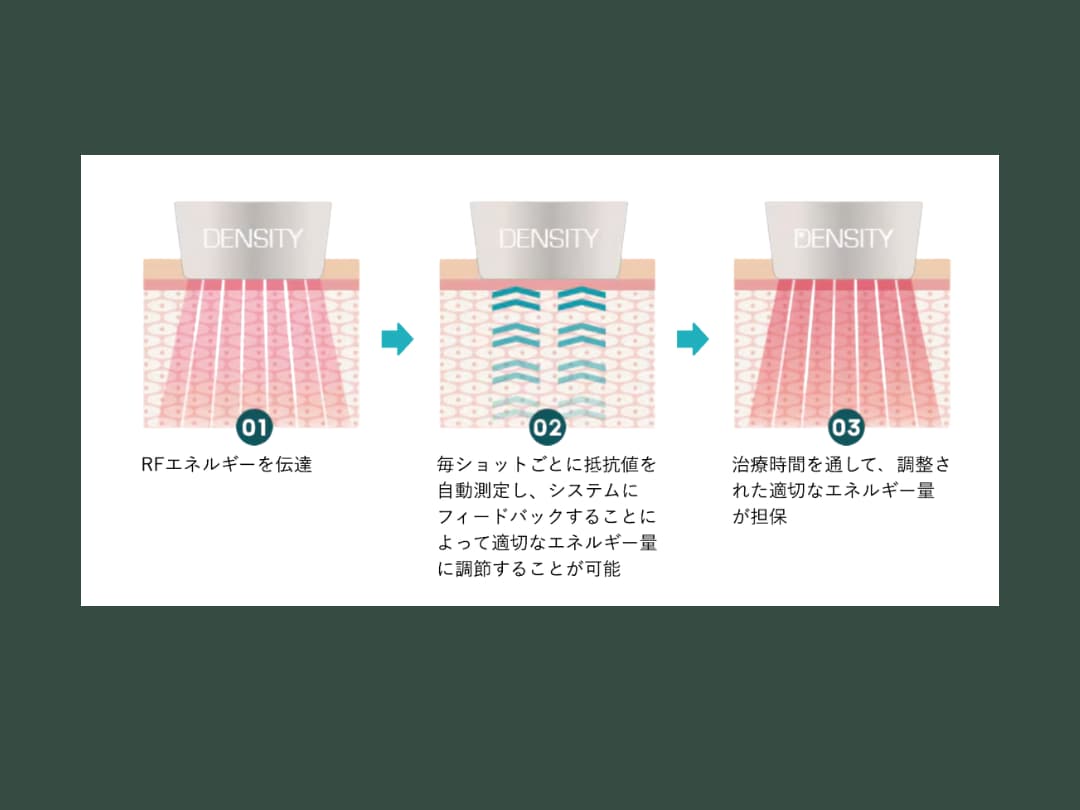 POINT2:エネルギー量をカスタマイズ