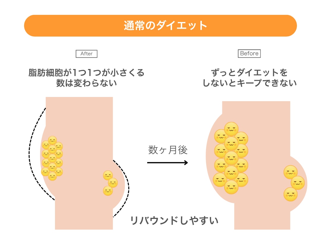 DOUSHITE1:通常のダイエット