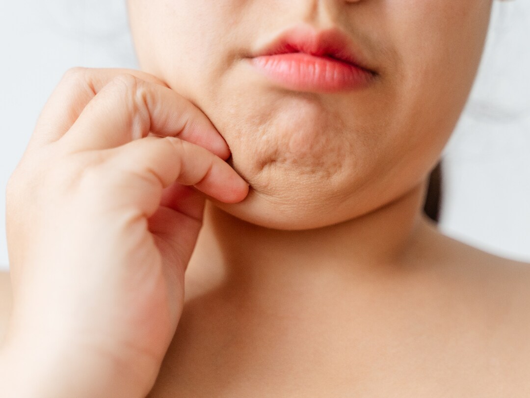 Point2：脂肪が多い