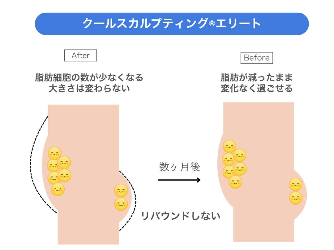 DOUSHITE2:クルスカダブルのダイエット