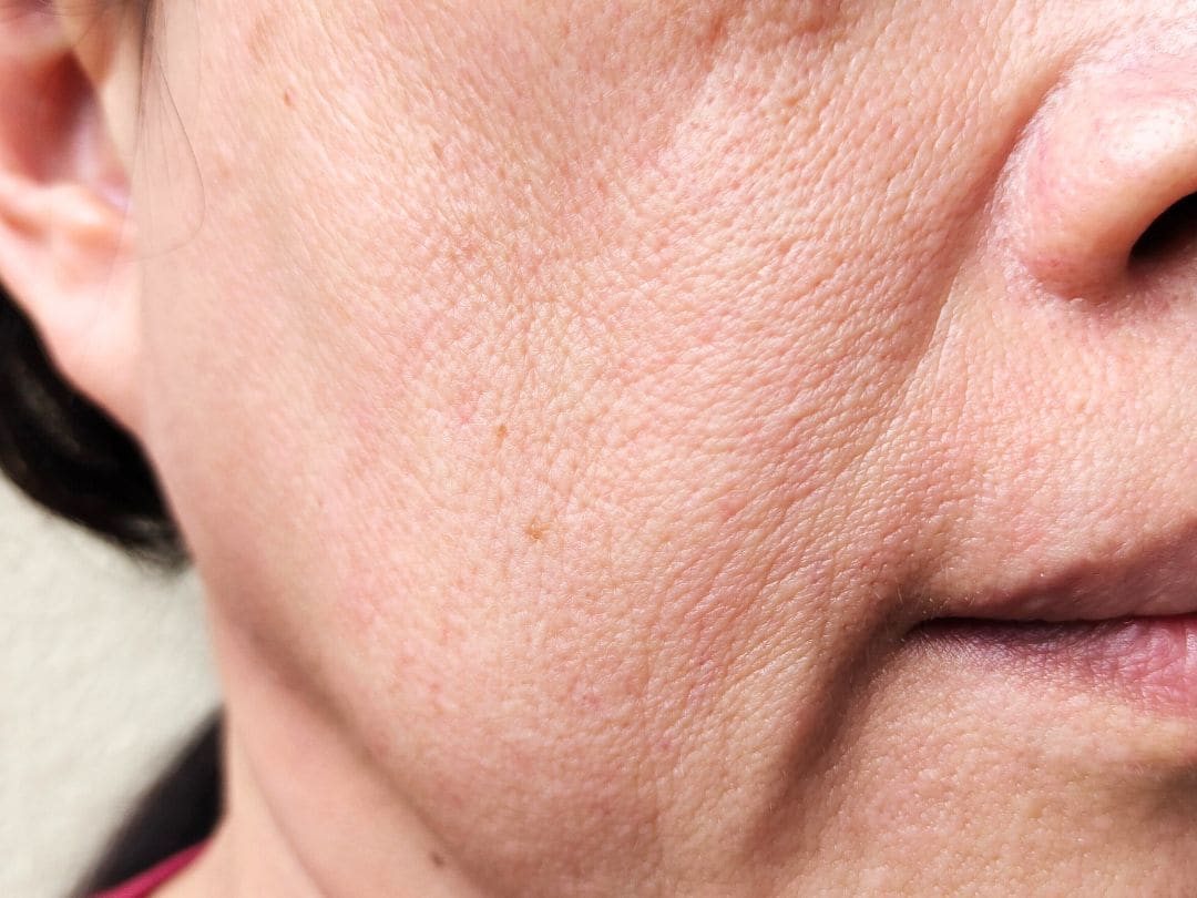 Point1：たるみが強すぎる