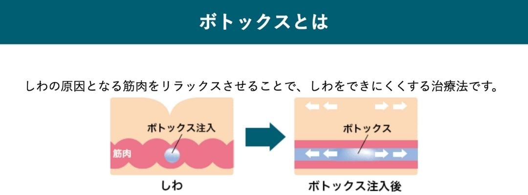 ボツリヌス菌がキーワード🔑