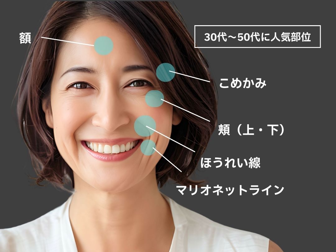 ＜30〜50代に人気の部位＞