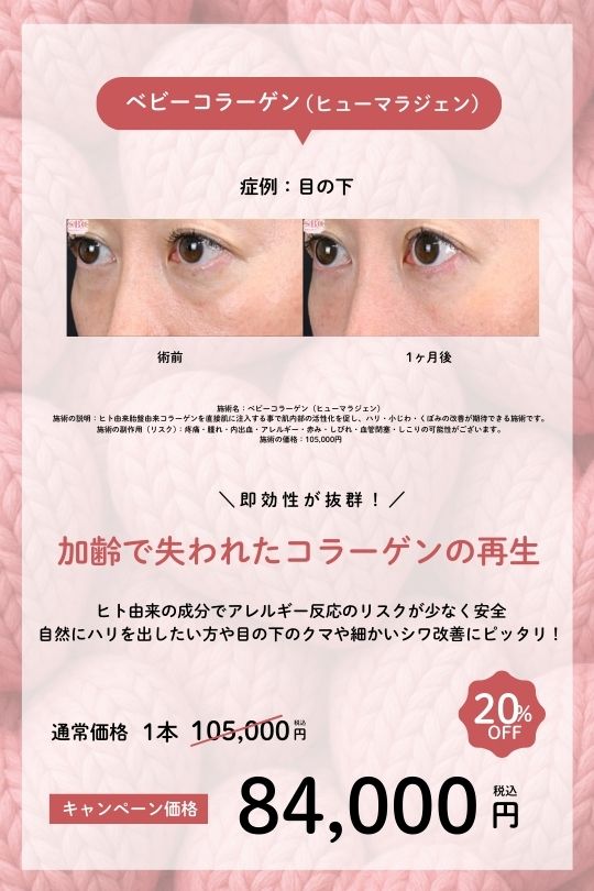 ベビーコラーゲン（ヒューマラジェン）　