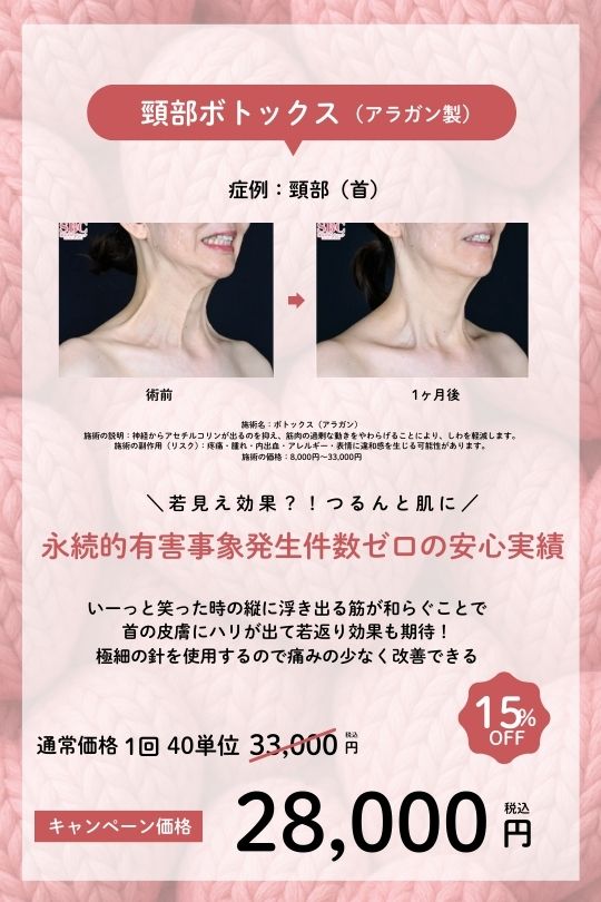 頸部(首)アラガン製ボトックス