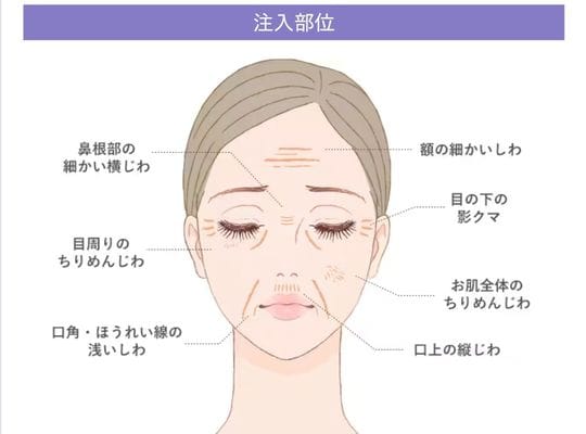 目の周りの薄い皮膚にも💧