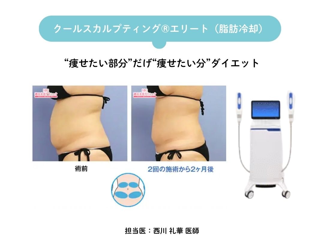 スマホ片手にダイエット？！