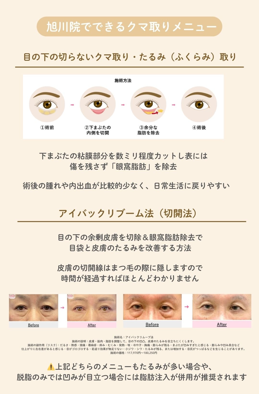 旭川院でできるクマ取りメニュー