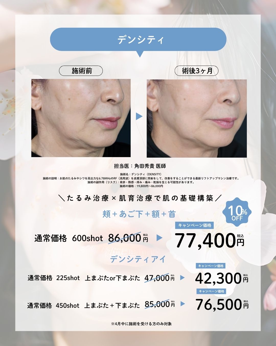 ⚫︎デンシティ　頬＋顎下＋額＋首　600shot