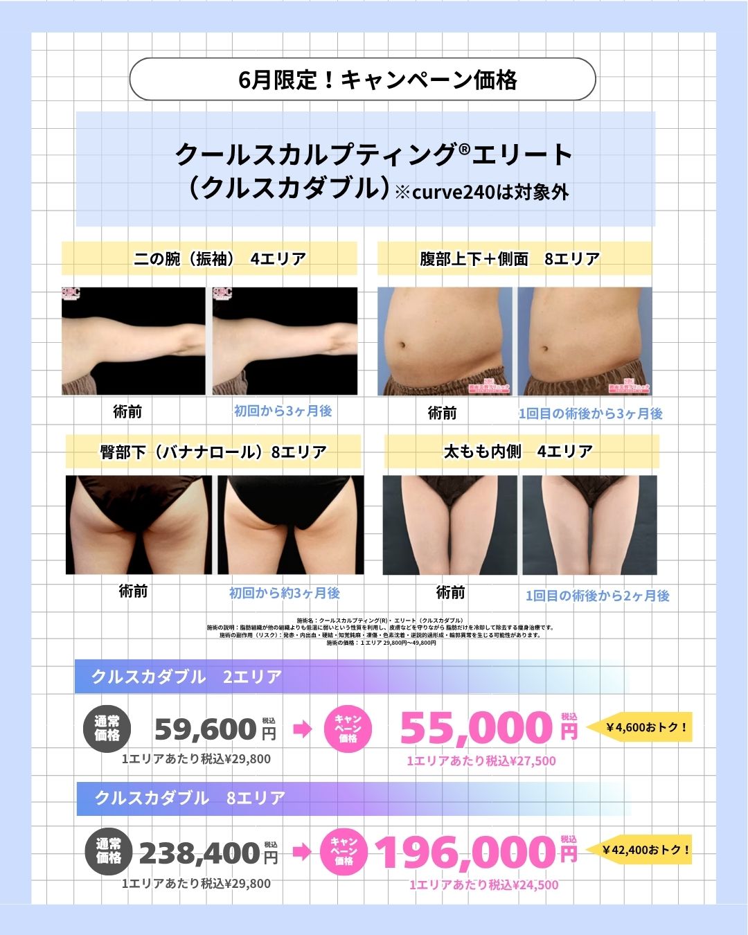 クールスカルプティング®エリート（クルスカダブル）