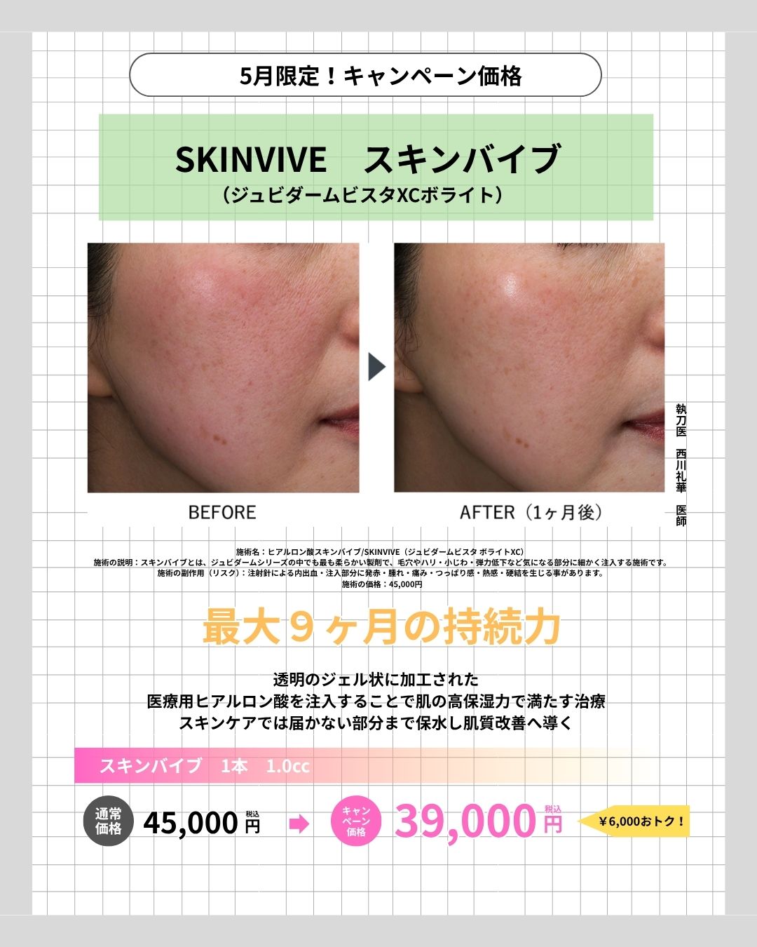 あなたの肌ドライじゃないですか？