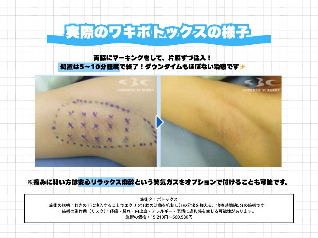 両ワキで約10分の手軽さ⏰