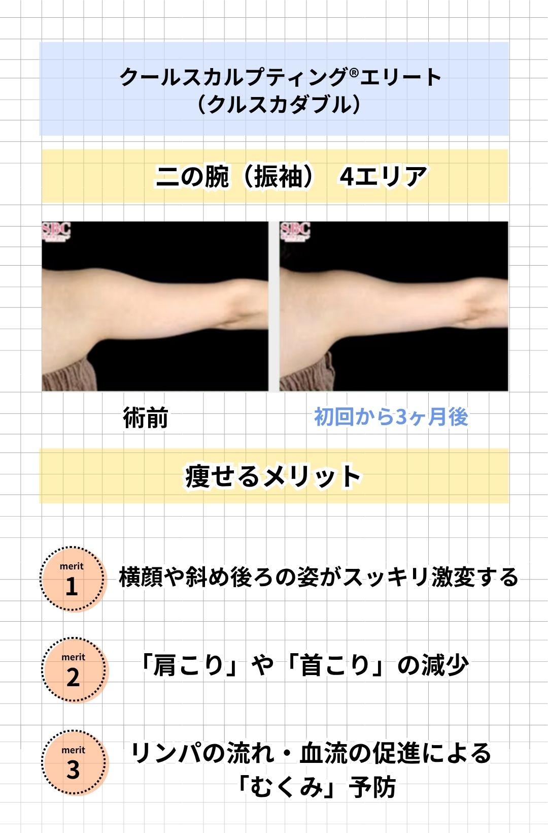 二の腕（振り袖）