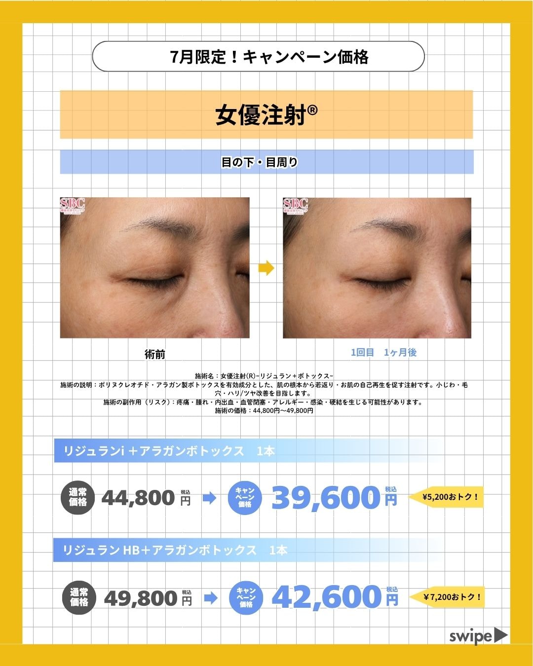 女優注射で隙のない陶器肌にへ🫧