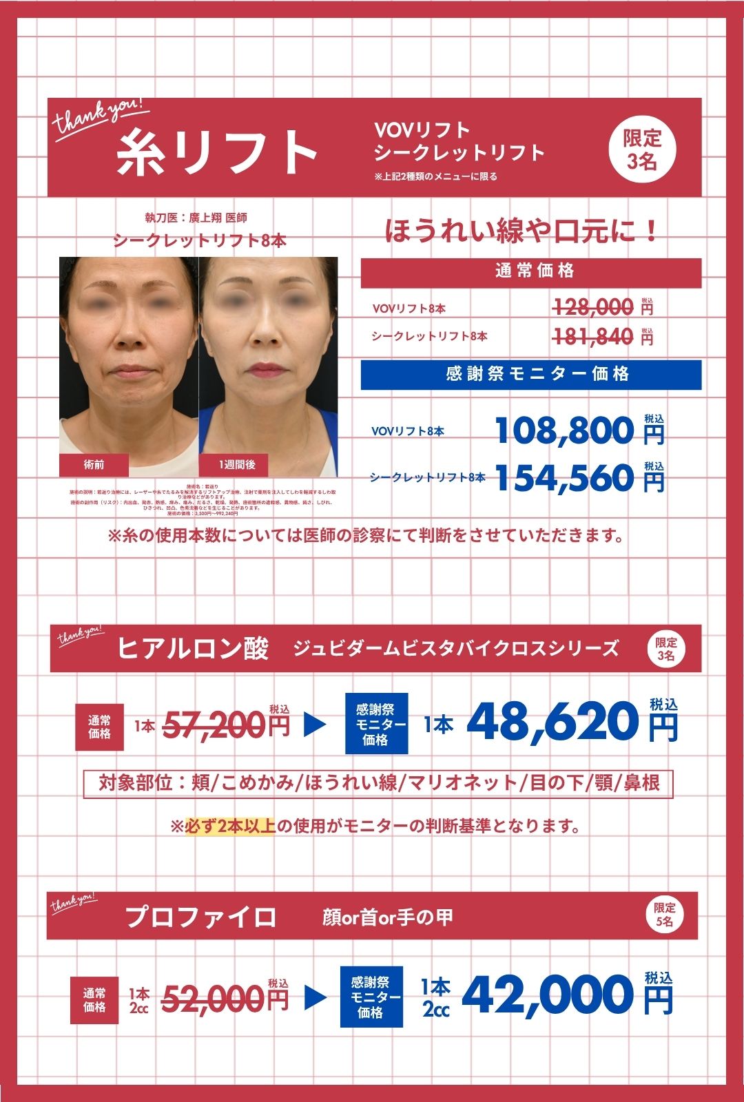 感謝祭キャンペーン❶