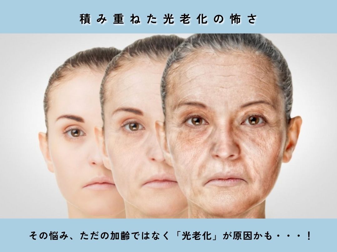 紫外線量は毎年増加傾向⤴️１０年後の未来のために