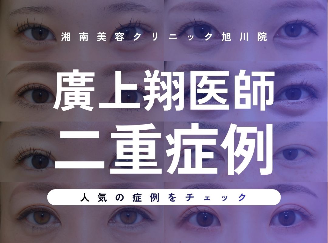 ★二重症例★廣上翔医師による2026年上半期症例まとめ【湘南美容クリニック 旭川院】