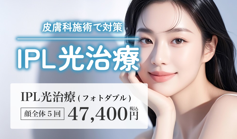 【攻めのケア】IPL光治療(フォトダブル/フォトトリプル)