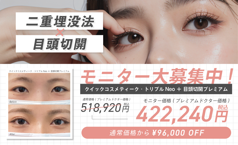 二重埋没×目頭切開モニター