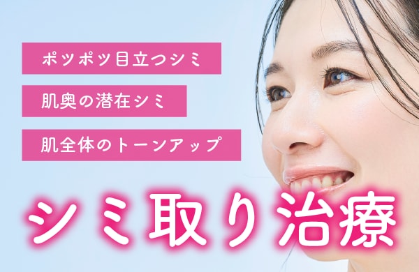 シミ取り治療