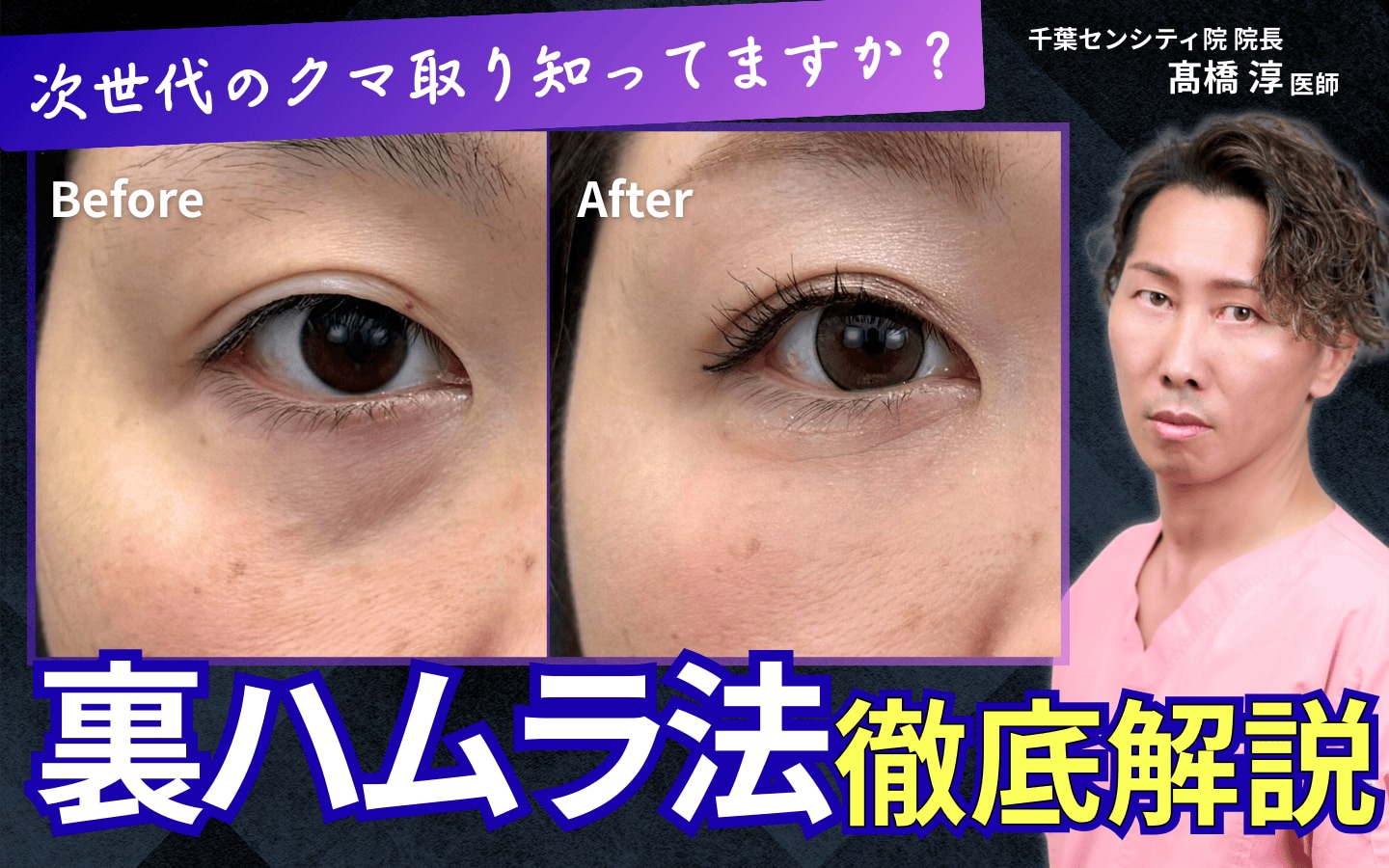【裏ハムラ完全ガイド】脱脂しない！？名医・髙橋淳医師が教える次世代のクマ治療
