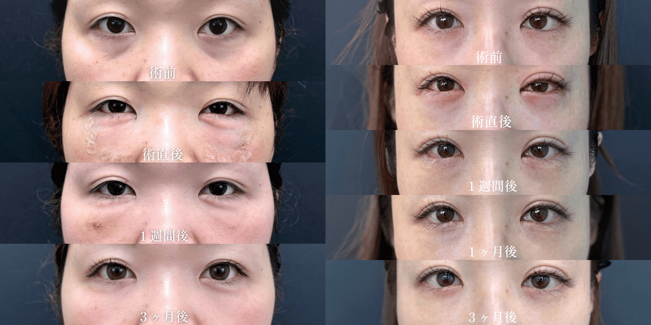 ダウンタイムはどれくらいですか？