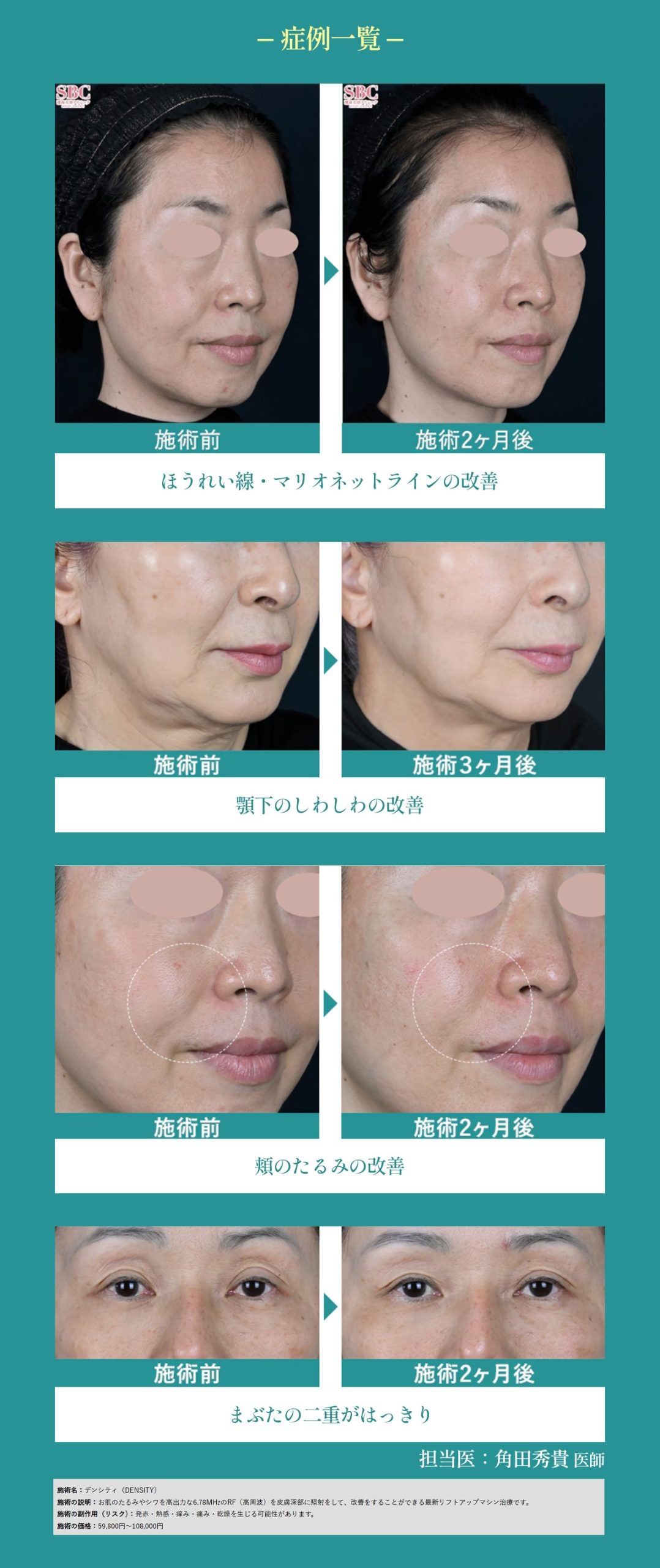 ビフォーアフター