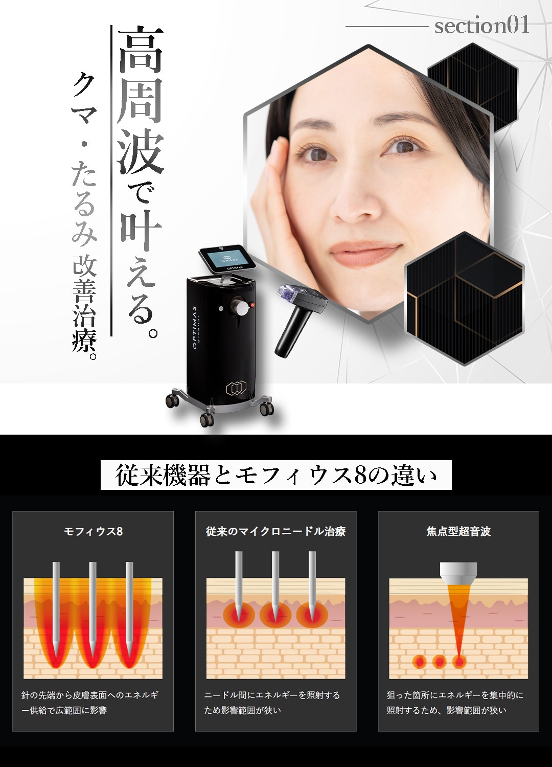 千葉センシティ院遂に導入】切らないクマ取り「モフィウス8」で叶える 