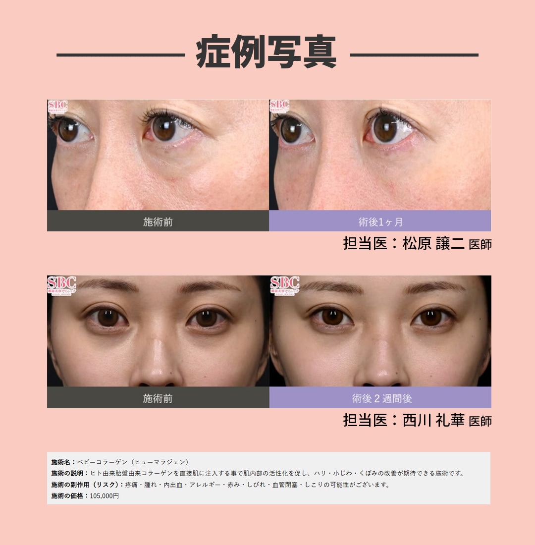 症例写真