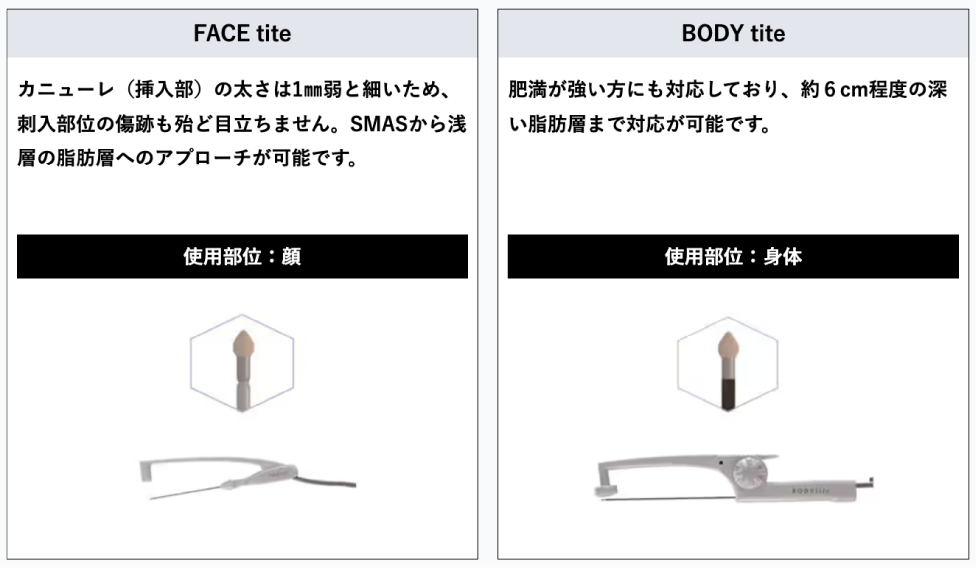 エンブレイスRFのメカニズム