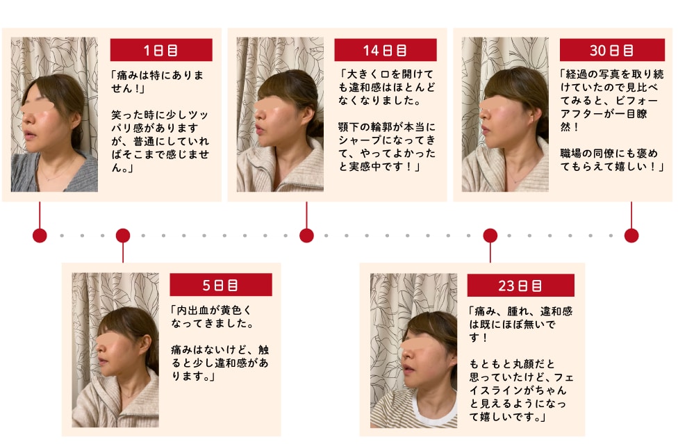 体験者のリアルな声