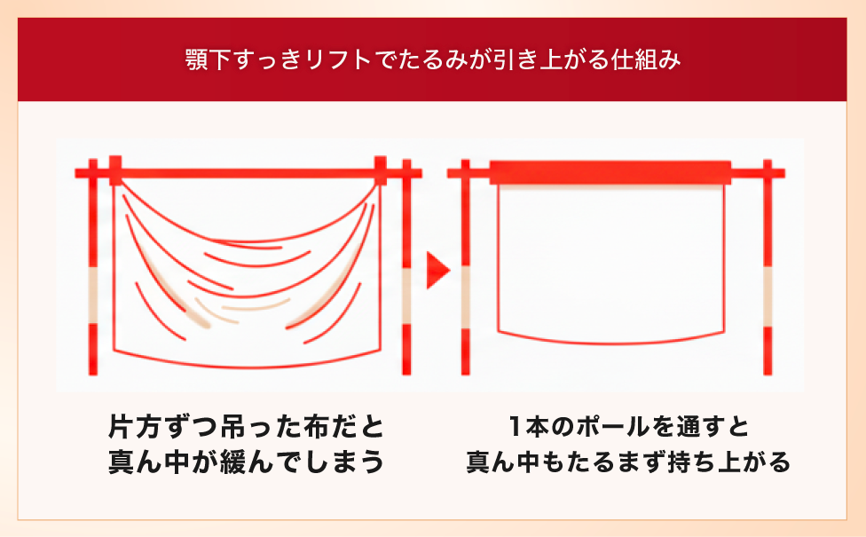 顎下専用の最新リフト