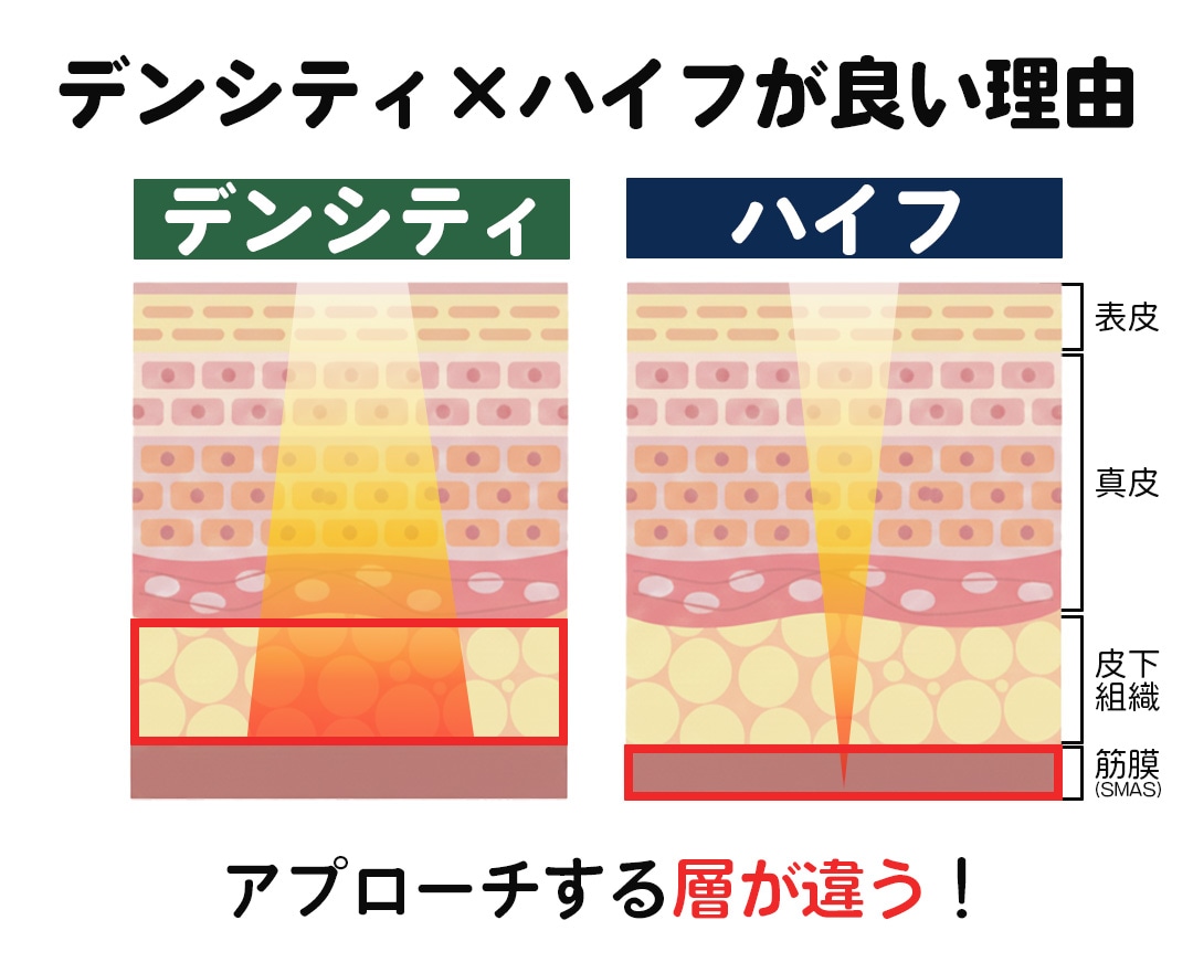 デンシティ×ハイフが良い理由