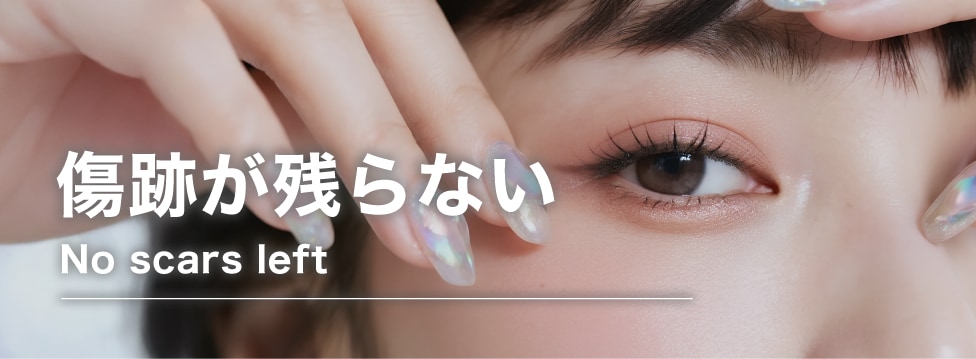 瞼に切開の傷跡ができない