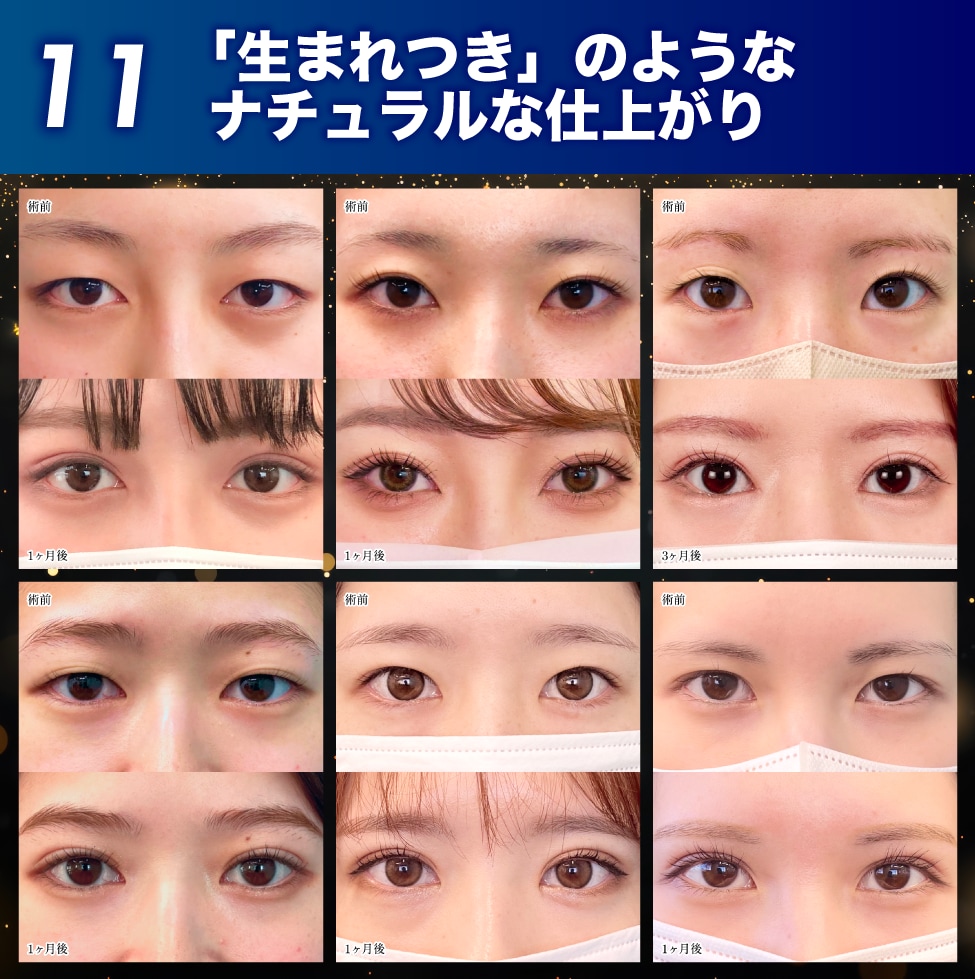 11.「生まれつき」を再現するナチュラルな仕上がり