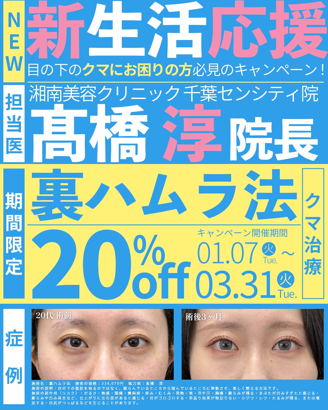 目の下のクマ治療！裏ハムラ法が２０％OFF✨