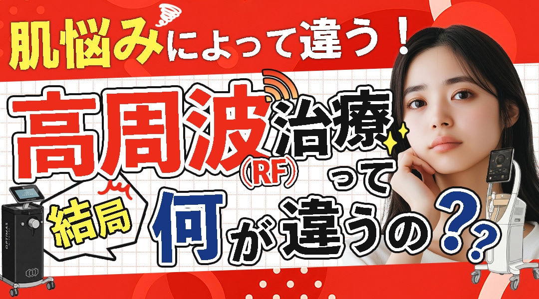 デンシティ？モフィウス８？話題の高周波治療（RF）って何が違うの？【千葉センシティ院】