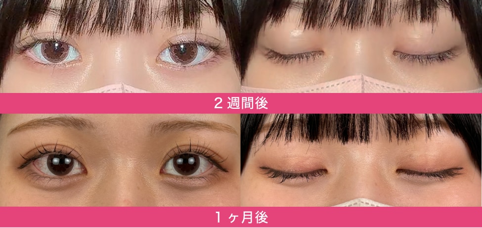 2週間〜1ヶ月（ほぼ完成に近づく時期）