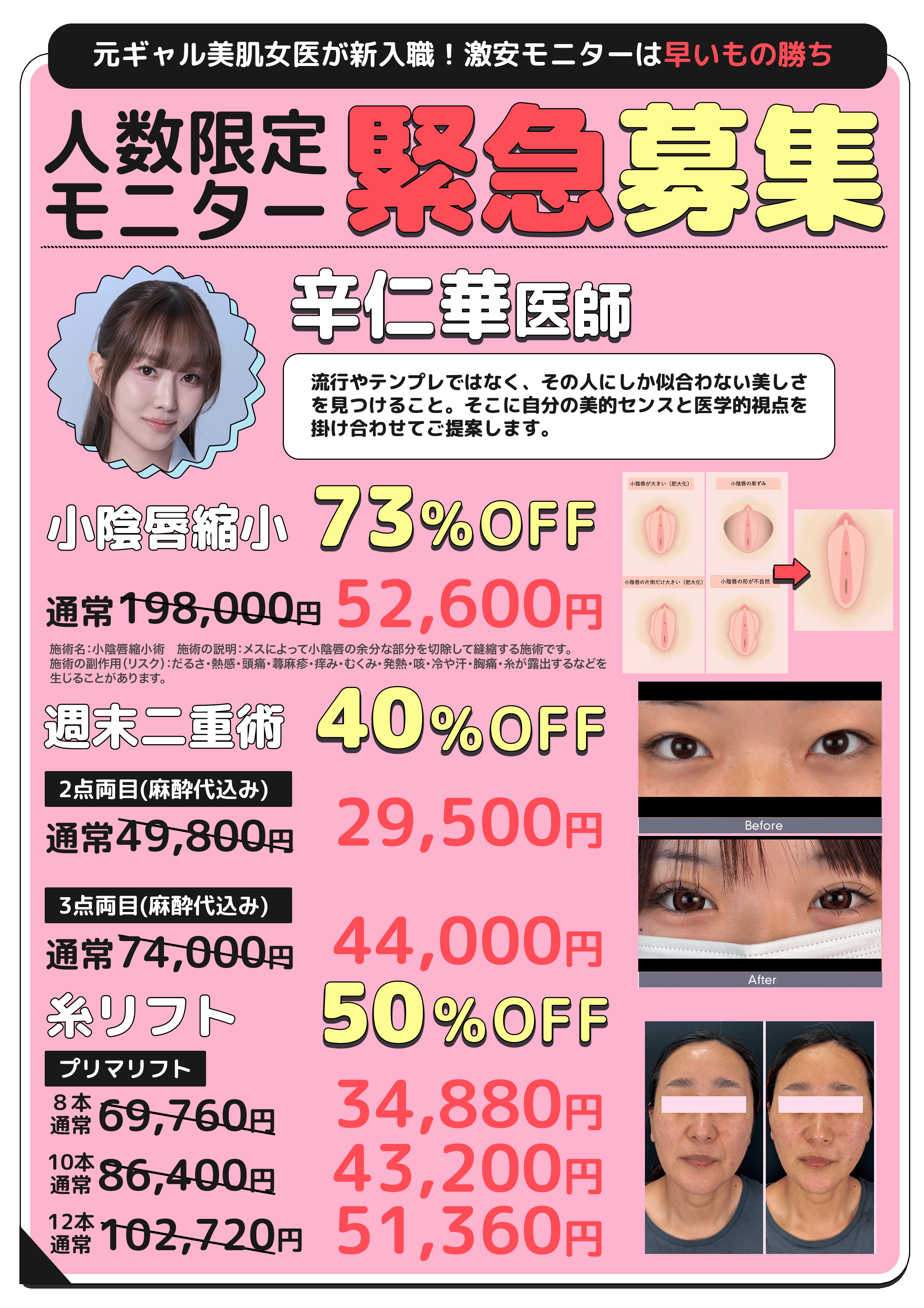 こんな激安価格・・・あと数年はないかも🤯