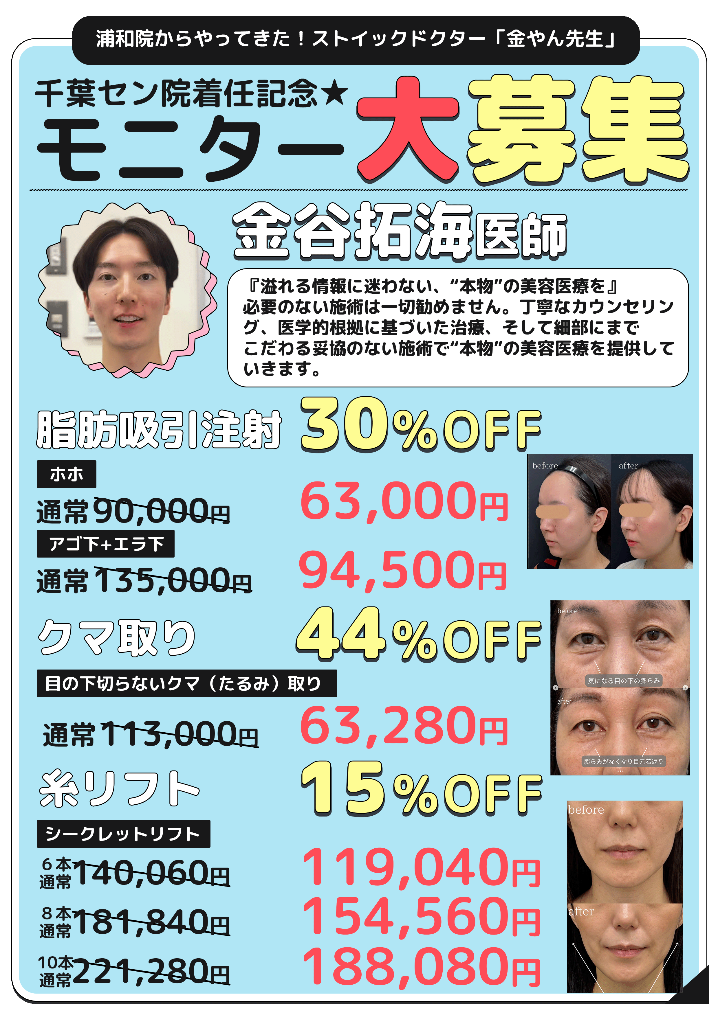 高クオリティな施術をお得に受けたい方いますか？✨🙋