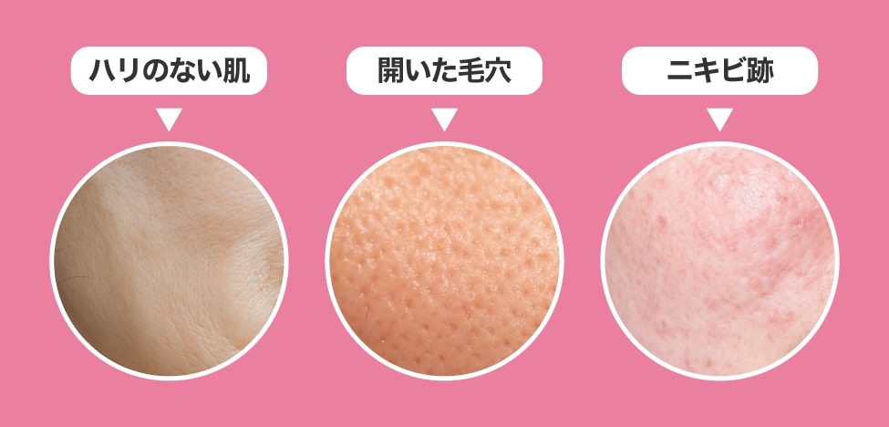 どんな悩みに向いているの？